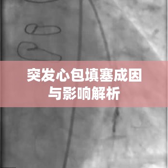 突发心包填塞成因与影响解析